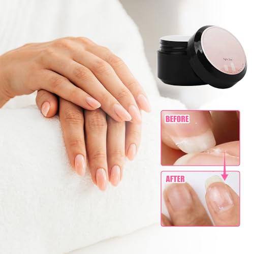 2025 New Nail Repair Protection Gel, Upgrade Instant Cracked Nail Repair Gel Nail Repair Kit for Cracked Natural Nails Quick Fix, Broken Nails Repair Kit for Natural Nails Kit (0.5 Fl Oz (Pack of 1))
