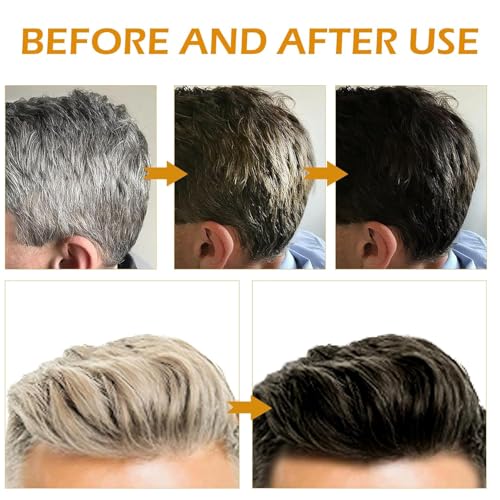 Gray Hair Reverse Bar Soap,Natural Black Soap for Gray Hair Coverage, Darkening Shampoo Bar with Ginseng & Black Sesame, Vegan, Moisturizing & Scalp Care for Men Women,2PACK