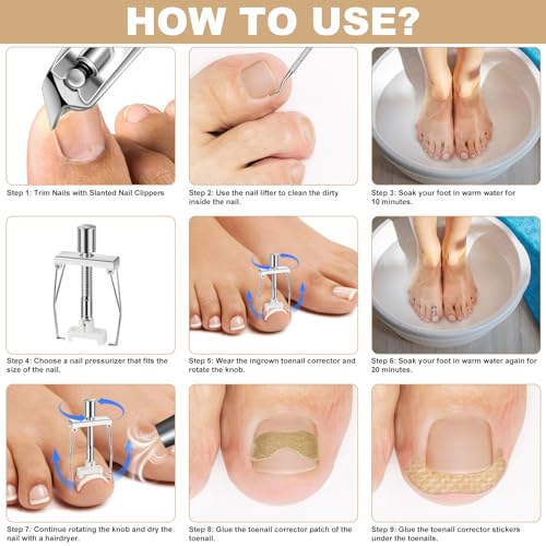 Ingrown Toenail Removal Kit, Professional Ingrown Toenail tool Kit with Ingrown Toenail Corrector, 50PCS Ingrown Toenail Corrector Patch & 30PCS Toenail Corrector Strips for Toe Pain Relief