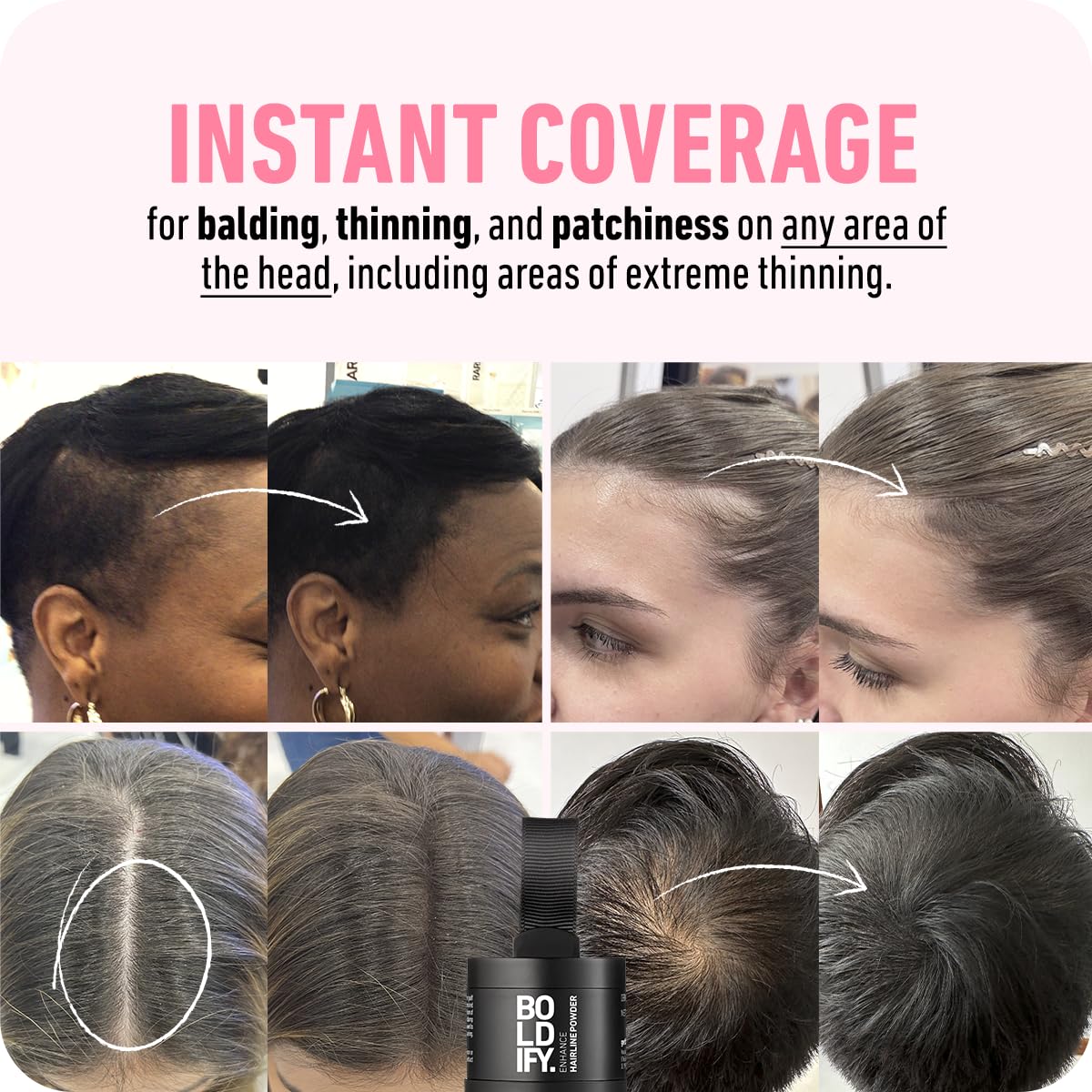 Boldify Hairline Powder + Hair Fiber: bundle that Instantly Conceals Hair Loss Hair Powder for Thinning Hair, Root Cover Up (Black)