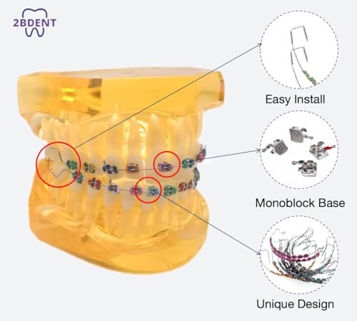 2 Pcs Temporary Tooth Decoration with Metal Wires Bracket Orthodontic Ligature Ties, Fashionable Colorful Fake Braces for Orthodontists Help Patients Understand Their Treatment (Blue)