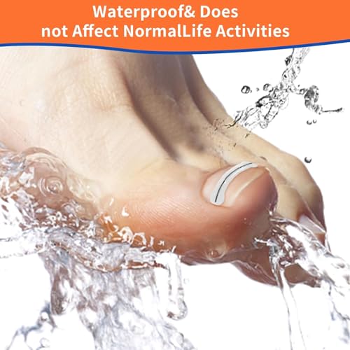 Ingrown Toenail Treatment Kit Titanium Alloy for Quick Relief - 5 Multi-Sizes, Nails Corrector Tool & Remover Strips - Ingrown Toe Nail Relief, Home Use - Men, Women and Kids