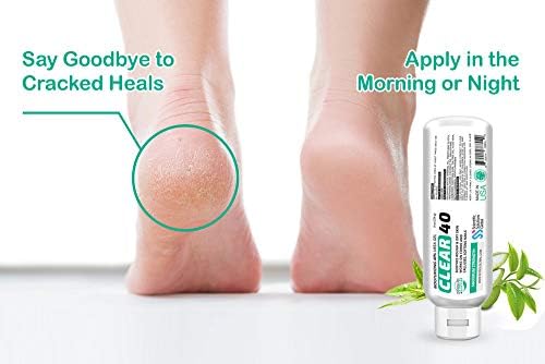 Clear 40, 40% Urea Gel, 8 oz w/Tea Tree & Coconut Oil, Aloe Vera Extract, Works on Calluses & Corns, Moisturizes & Softens Cracked Heels, Feet, Elbows, Hands, Nails, Superior Hydration to Urea Creams