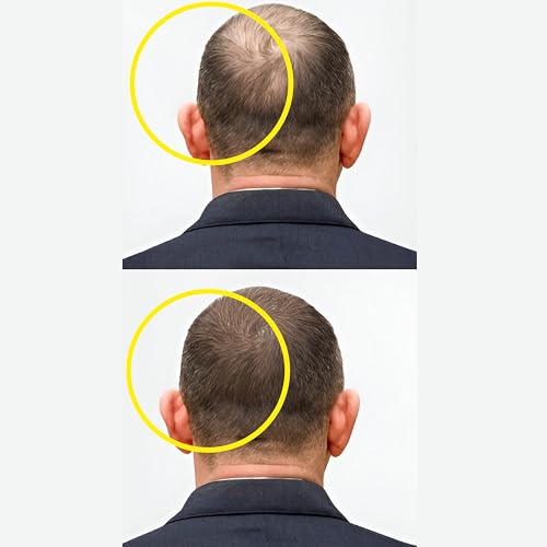 Hair Growth Serum with 3% Redensyl, 5% Capixyl, 4% Anagain, 3% Procapil & 3% Baicapil, Rosemary & Biotin For Hair fall Control & Promoting Hair Growth, For Both Men & Women, 1.01 fl.oz./30ML