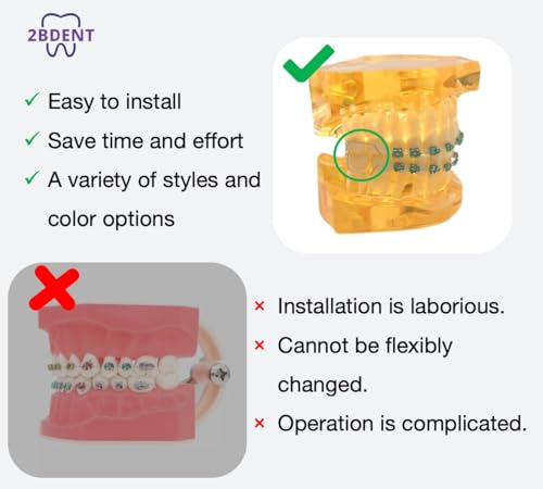 2 Pcs Temporary Tooth Decoration with Metal Wires Bracket Orthodontic Ligature Ties, Fashionable Colorful Fake Braces for Orthodontists Help Patients Understand Their Treatment (Blue)