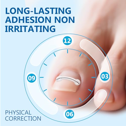 Ingrown Toenail Treatment, Titanium Alloy Ingrown Toenail Removal Kit for Repair Curved Nail, Ingrown Toenail Corrector Tool for Home Use