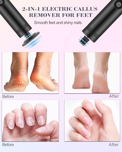 2 in 1 Electric Foot Callus Remover, 9 Speed Adjustable Foot Sander with LED Display, Electric Foot Grinder with 2000 mAh Rechargeable Battery, for Callus Removal, Replaceable Sandpaper Discs (Black)