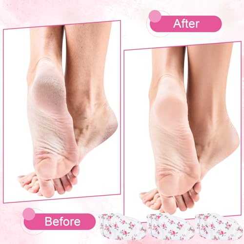 12 Pairs Moisturizing Socks Overnight for Dry Feet Spa Lotion Sleeping Socks Cosmetic Moisturizing Dry Feet Healing Care for Cracked Skin Women Men