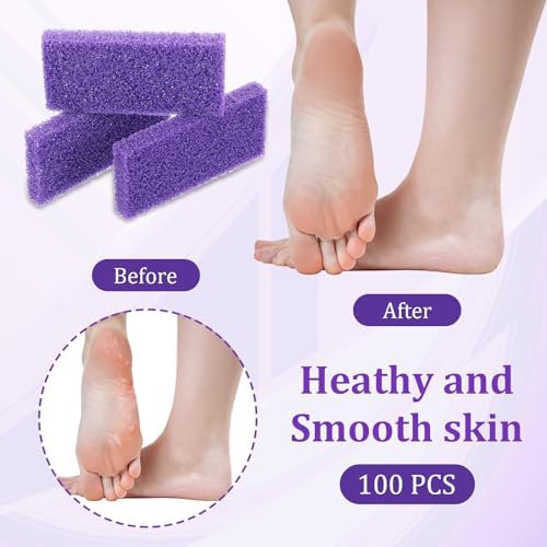 100 Pcs Pumice Stone for Feet Scrubber Dead Skin Disposable Foot Scrubber Pumice Pads Foot Pumice Foot Callus Remover for Feet Pedicure Foot Heel Exfoliator Tool Purple Pumice Sponge Salon Home Use