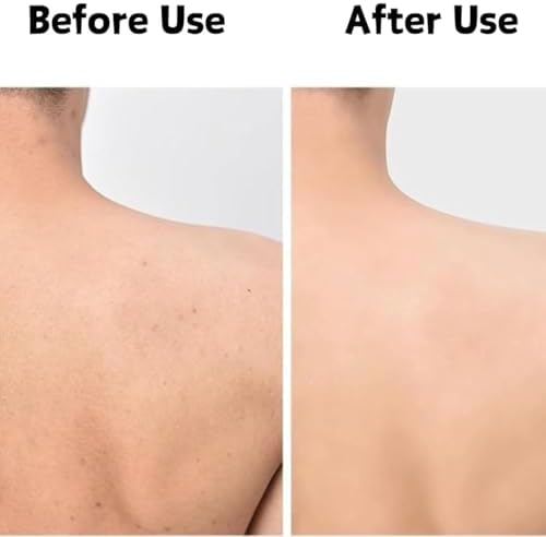 Blissal Exfoliating Shower Towel - Long Washcloth Back Body Scrubber for Men & Women (Black)