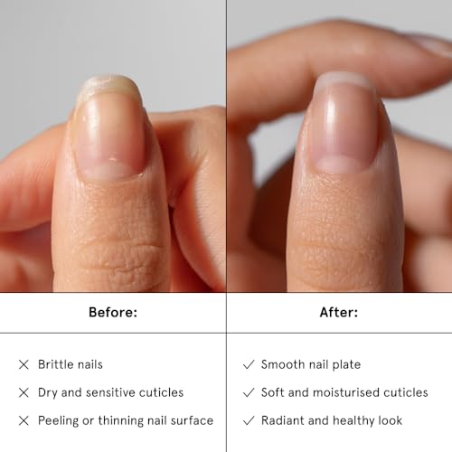 gitti Restoring Nail Serum I Natural Nail Care, Non-Toxic, Plant-based, 98% Natural Origin, Cruelty-Free, Vegan I Hydrating, Helps Strengthens Nails, Non-Greasy, Nail Recovery (0.5 fl oz)