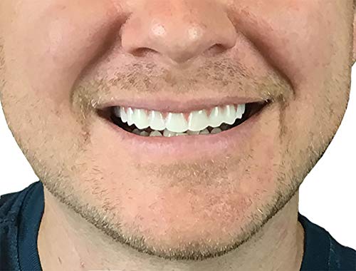 Instant Smile Comfort Fit Flex Natural Shade