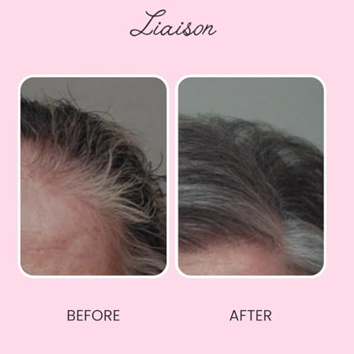 Gray Repair Hair Serum for Women| Limits Hair Greying | Revives Natural Color |With Panax ginseng | Polygonum multiflorum, Ginger root extract