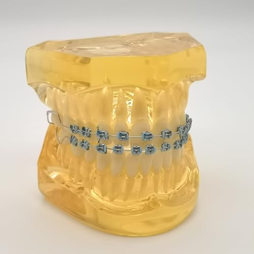 2 Pcs Temporary Tooth Decoration with Metal Wires Bracket Orthodontic Ligature Ties, Fashionable Colorful Fake Braces for Orthodontists Help Patients Understand Their Treatment (Blue)