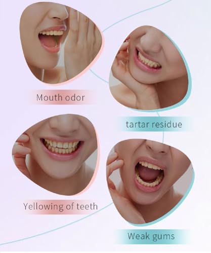 2Pcs Niacinamide Intensive Whitening Toothpaste,Acssart Radiant Whitening Toothpaste with Natural Gentle Care Deep Stain Removal Clean,Improves Gum Health,Fresh Breath