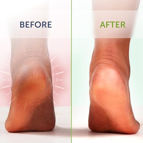 14oz Tea Tree Oil Foot Soak with Epsom Salt and Mint by Truremedy Naturals - Foot Soaking Salts for Dry and Tired Feet - Gently Exfoliates and Refreshes Feet for Soft, Supple Skin