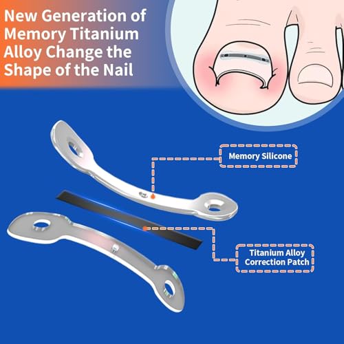 Ingrown Toenail Treatment Kit Titanium Alloy for Quick Relief - 5 Multi-Sizes, Nails Corrector Tool & Remover Strips - Ingrown Toe Nail Relief, Home Use - Men, Women and Kids