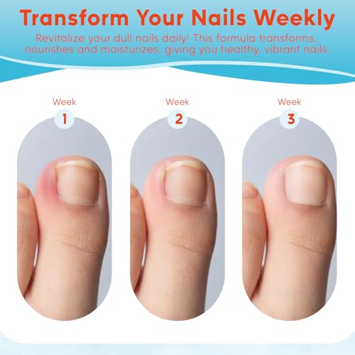 Ingrown Toenail Kit, Ginger Ingrown Toenail Treatment, Drops with Tools for Big Toe Ingrown Pain Relief, Toenail Clippers For Thick & Ingrown Nails, Ingrown Toenail Removal Kit