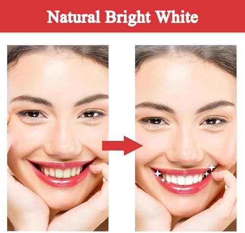 2 Pack SP-10 Probiotic Whitening Toothpaste – Ultra Whitening & Stain Removal, Deep Cleaning, Fresh Breath Formula with Probiotics