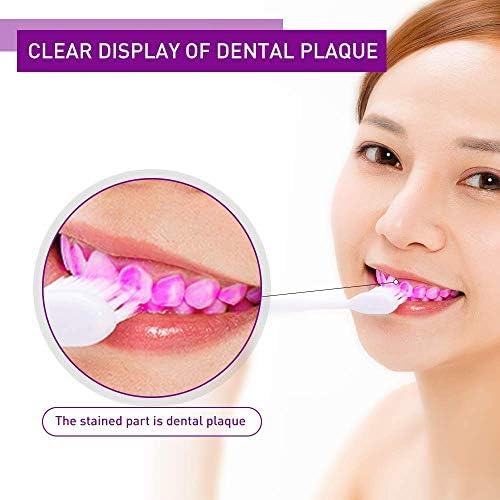 Dental Plaque Disclosing Tablets for Kids & Adults - Showing Plaque by Changing Color - Helps Teach Brushing Habits for Clean Teeth - 108Count