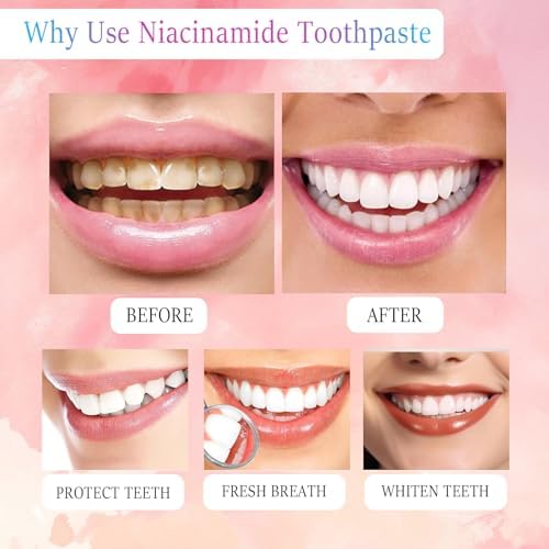 2PCS Niacinamide Whitening Toothpaste-Probiotic Whitening Toothpaste, Intense Triple Whiten, Fluoride-Free, Gentle Mint, Breath Freshening (2pcs)