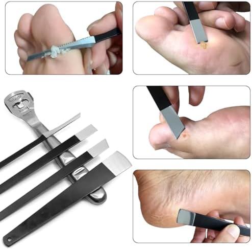 36 Pcs Callus Shaver for Feet Set, (1Stainless Foot File &1 Foot File Heads & 30 Replacement Slices Blades & 4 Pedicure Knife), Professional Callus Remover for Feet Tools for Wet and Dry Feet