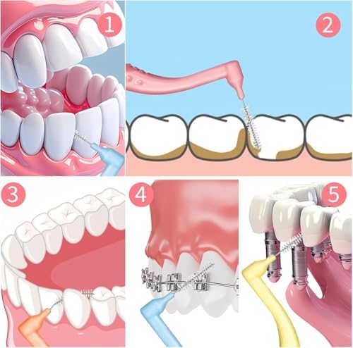 100pcs Interdental Brushes, 5 Sizes Braces Brush Set Soft Dental Brushes with Non-Slip Handle Angled Head Tooth Picks Floss Sticks Dental Floss Brushes for Braces Oral Cleaning