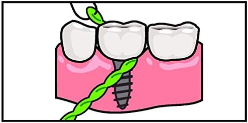 Brace X-Floss, Green