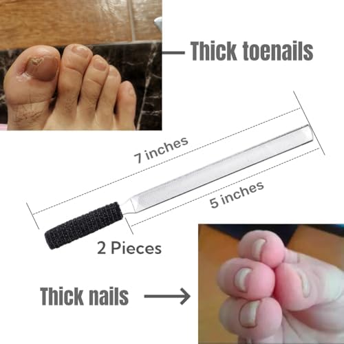 2-Piece Stainless Steel Toenail File for Thick Nails | 4-Sided Design with Non-Slip Grip & Thumb Protector | 7" Durable Metal Nail File for for All, Elderly & Dogs