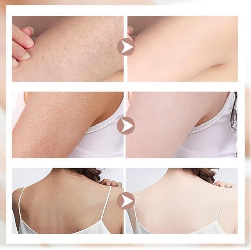 2025 New Super Soft Sunflower Suction Cup Bath Ball, 2-in-1 Sunflower Bath Ball Exfoliating Bath Sponge Cleaning Brush, Mesh Sponge Pouf Shower Ball for Women Men (Pink)