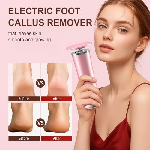 10-in-1 Electric Foot Callus Remover, Adjustable Speed Electric Callus Remover for Feet with 60 Sanding Pads, Foot Callus Remover, Heel Scraper for Cracked Heels (Rose Pink)