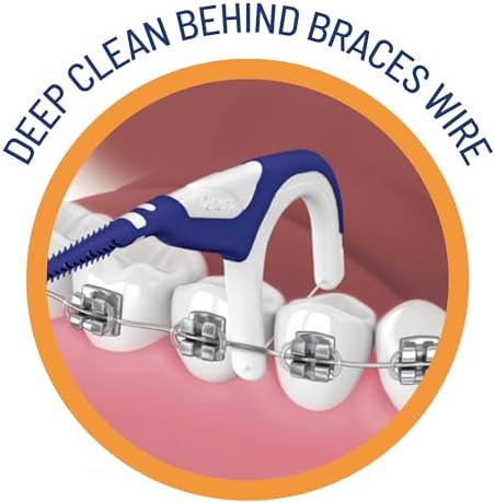 Braces Flosser - Designed for Braces for an Easy & Effective Clean, Ultra Strong Floss - 40 Count (Pack of 2)