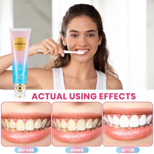 2Pcs Niacinamide Whitening Toothpaste Radiant Whitening Toothpaste, Niacinamide Intensive White Toothpastes, Nicotinamide White Toothpastes, Deep Cleaning Care