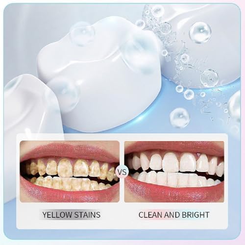 2Pcs Niacinamide Intensive Whitening Toothpaste,Acssart Radiant Whitening Toothpaste with Natural Gentle Care Deep Stain Removal Clean,Improves Gum Health,Fresh Breath
