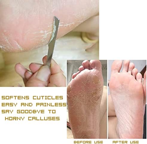 3PCS Stainless Steel ingrown toenail Pedicure Knife Set, Professional Foot Skin Scraper Repair Sharp Blade kit for Nail Corn Callus Paronychia Treatment (with Holes)