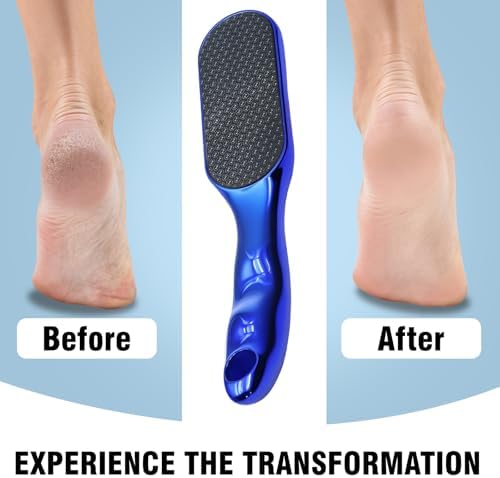 2 Pcs Veinsgrain Foot File, Nano Glass Foot File Hard Skin Remover with Non-Slip Ergonomic Handle, Professional Foot Care Tools for Smooth Feet(Gold+Blue)