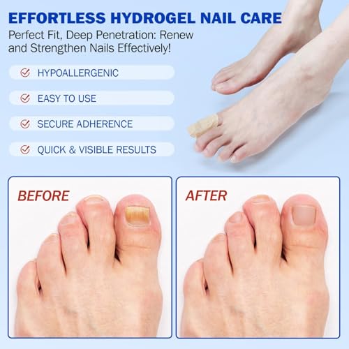 42pcs Toenail Fungus Treatment Extra Strength,Nail Patches for Nail Treatment Overnight,Nail Repair for Damaged Nails Care