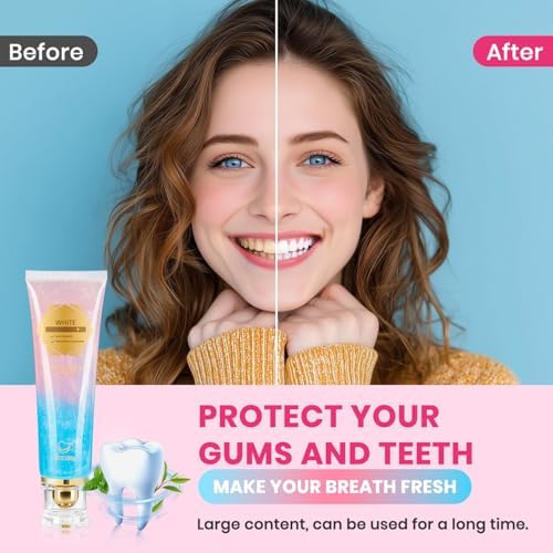 2Pcs Niacinamide Whitening Toothpaste Radiant Whitening Toothpaste, Niacinamide Intensive White Toothpastes, Nicotinamide White Toothpastes, Deep Cleaning Care