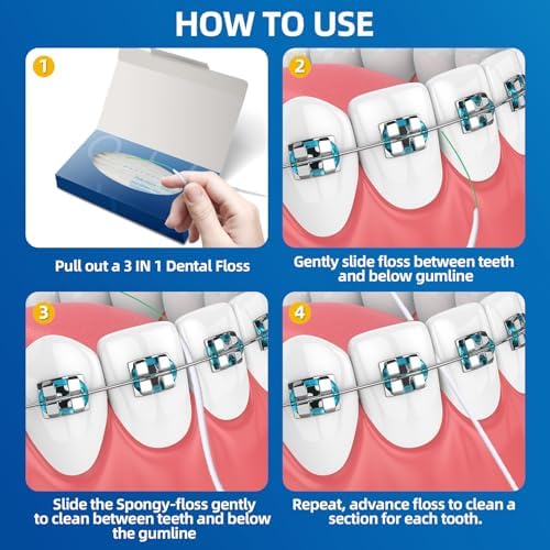 Bopika Dental Floss for Braces, 3 in 1 Ultimate Floss, Floss Threaders for Bridges and Implants, 80 Pre-Cut Strands (Pack of 3)