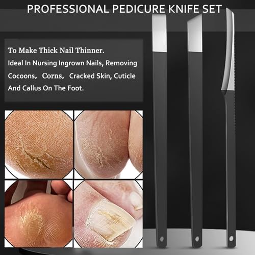 Ingrown Toenail Clipper Nail Cutter Pedicure Knife Thick Nail Clipper Senior Callus Remover Tools Men Women