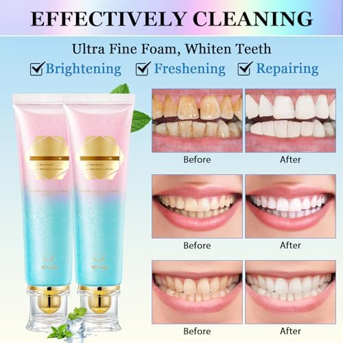 2Pcs Acssart Radiant Niacinamide Intensive Whitening Toothpaste, Niacinamide White Toothpastes, Remove Tooth Stains, Fresh Breath