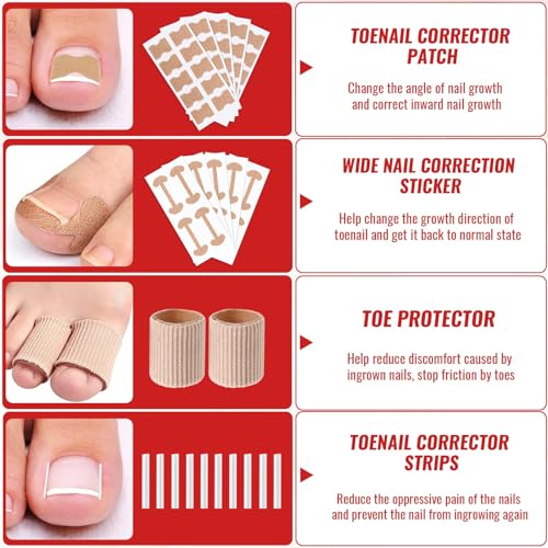 Ingrown Toenail Removal Kit, Ingrown Toenail Relief Tool Kit with Ingrown Toenail Corrector, Ingrown Toenail Drops, Corrector Patch, Toenail Clipper, Nail File Lifter Tools