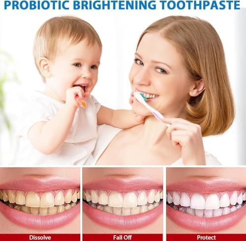 2PCS Sp 6 Probiotic Toothpaste Whitening Sp-6 Probiotics Whitening Toothpaste Fresh Flavor and Gum Health