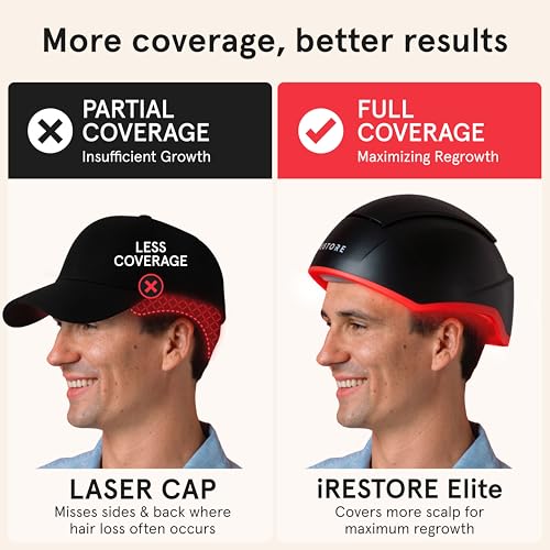 iRestore Elite - Laser Red Light Therapy for Hair Growth System - FDA Cleared Hair Loss, Hair Thinning & Alopecia Treatment for Men & Women - Laser Cap for Hair Regrowth Stimulates Denser Fuller Hair
