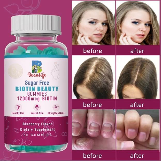 Biotin Collagen Gummies, Hair Skin and Nails,for Women & Men, Biotin, Chlorophyl, Collagen, Biotin Supplement, 60 Gummy Bears