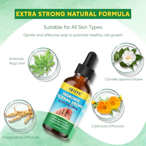 Ingrown Toenail Tools Kit, Ingrown Toenail Treatment, Stainless Steel Ingrown Toenail Removal Kit, Ingrown Toenail Corrector, Corrector Patch, Toenail Clipper, Nail File Lifter Pedicure Tool