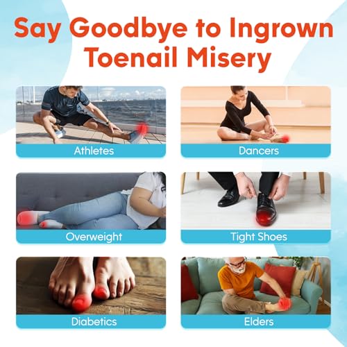 Ingrown Toenail Kit, Ginger Ingrown Toenail Treatment, Drops with Tools for Big Toe Ingrown Pain Relief, Toenail Clippers For Thick & Ingrown Nails, Ingrown Toenail Removal Kit