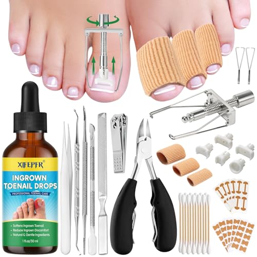 Ingrown Toenail Tools Kit, Ingrown Toenail Treatment, Stainless Steel Ingrown Toenail Removal Kit, Ingrown Toenail Corrector, Corrector Patch, Toenail Clipper, Nail File Lifter Pedicure Tool