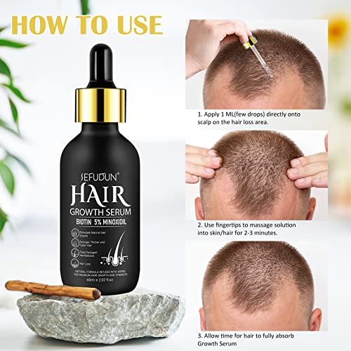 2PCS 5% Minoxidil Hair Growth Serum for Men & Women - Natural Hair Regrowth Oil, Nourishes Scalp & Moisturizes Hair - 4.04 oz