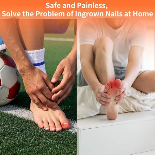 Ingrown Toenail Treatment Kit Titanium Alloy for Quick Relief - 5 Multi-Sizes, Nails Corrector Tool & Remover Strips - Ingrown Toe Nail Relief, Home Use - Men, Women and Kids